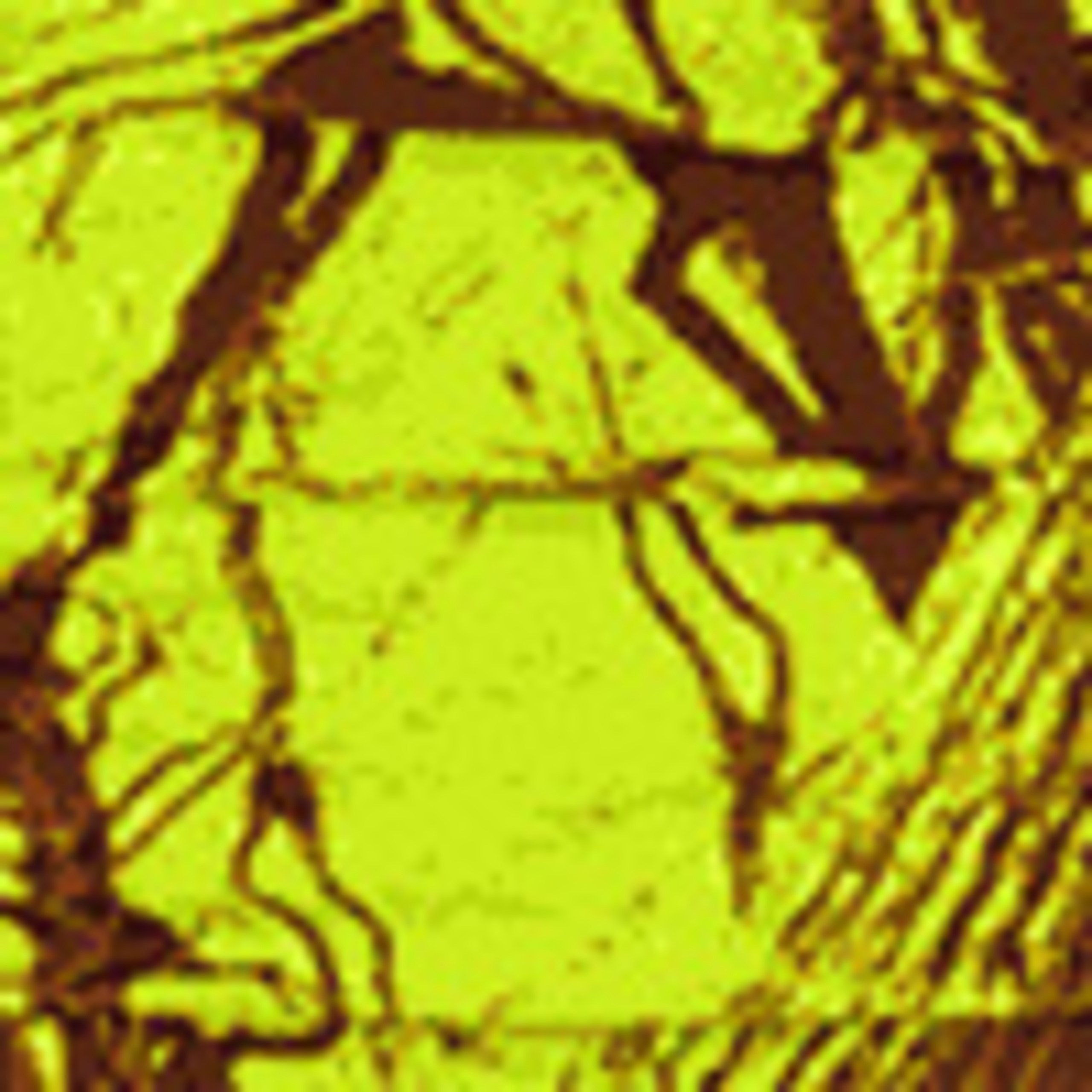 Camouflage neon yellow