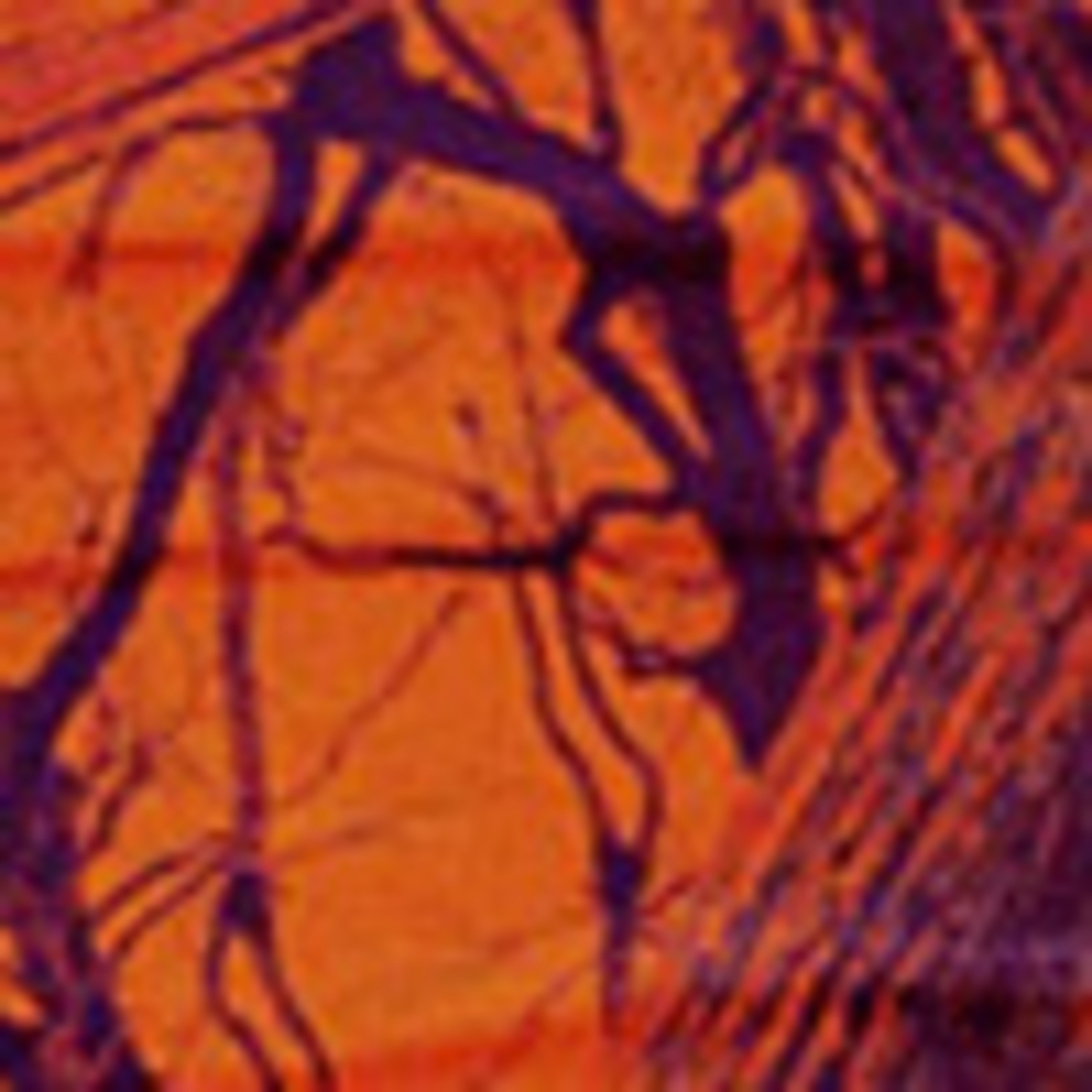 Neon camouflage